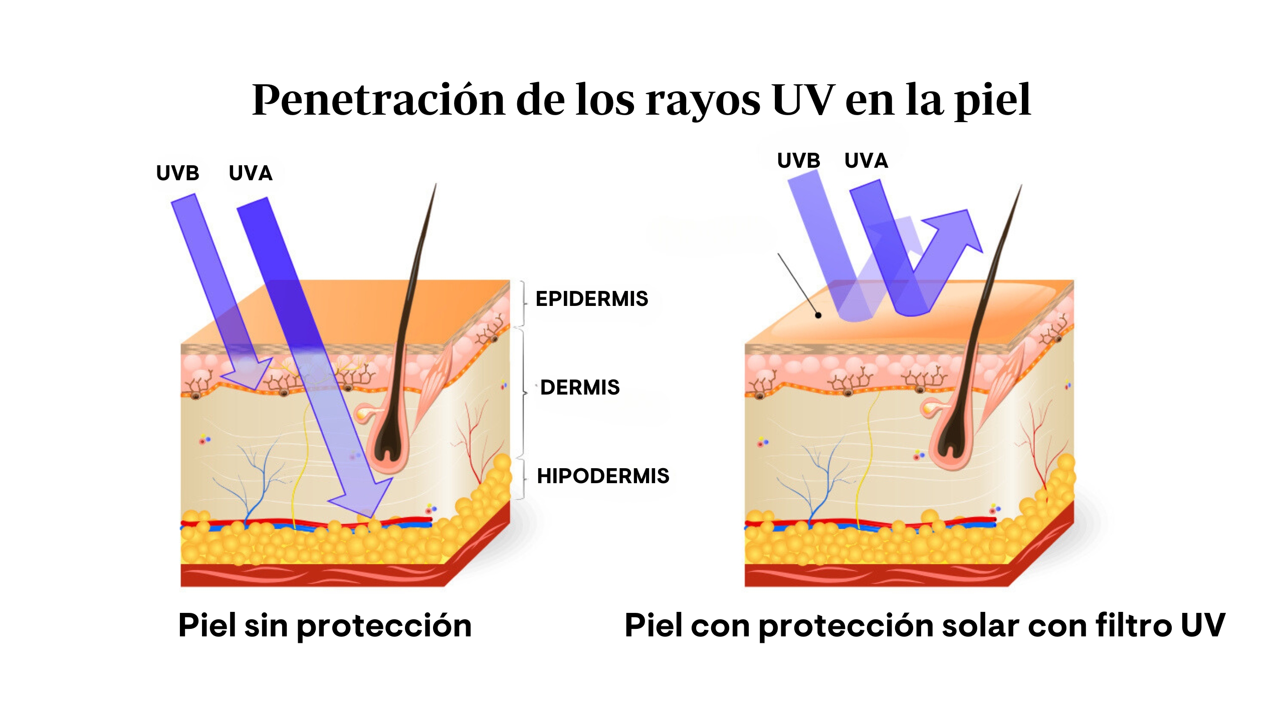 Efectos Del Sol En Nuestra Piel ¿solo Debemos Preocuparnos Durante El Verano Viu Internacional 9201